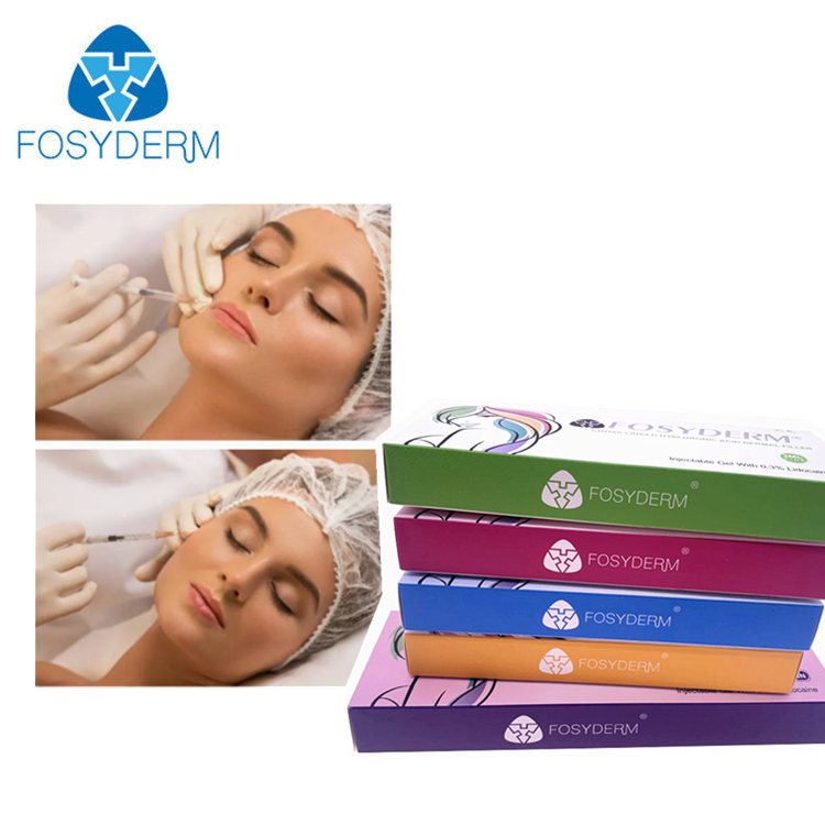 Filler dermico iniettabile a base di acido ialuronico ad alta viscosità per correzione del volume di zigomi, mento, naso e labbra