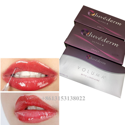Juvederm Voluma Acido ialuronico Gel di riempimento cutaneo 24mg/ml Riempitori cutanei