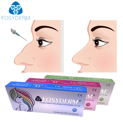 Iniezione cutanea acida ialuronica 1ml 2ml del riempitore del naso per usando femminile
