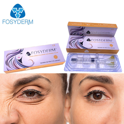 l'iniezione cutanea acida ialuronica del riempitore di 5ml Fosyderm per le labbra fiuta