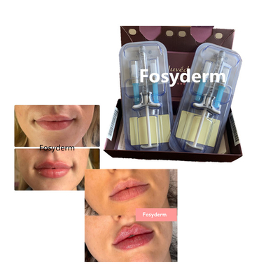 L'incrocio acido ialuronico del riempitore delle labbra di volbella di Juvederm ha collegato 24mg