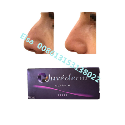 Juvederm Sodium Ultra4 Voluma Dermal Filler per l' aumento del mento