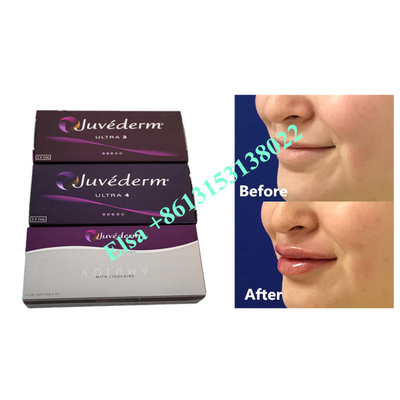 Iniezione di filler dermico Fosyderm di acido ialuronico Voluma 24 mg / ml