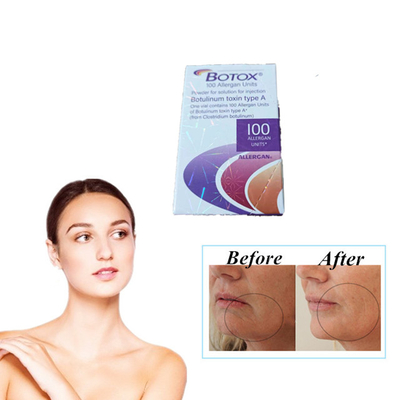 Allergan  100 unità Tipi di iniezione di tossina botulinica antirughe