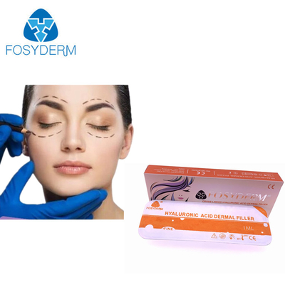 Filler cutaneo a lunga durata dell'acido ialuronico di Fosyderm per l'iniezione cosmetica
