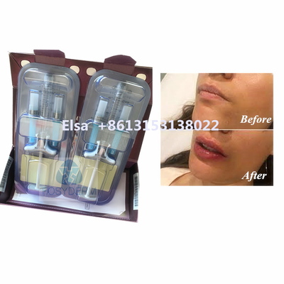 Prodotto di bellezza Juvederm Voluma Acido Ialuronico Iniezione di caricatore facciale HA