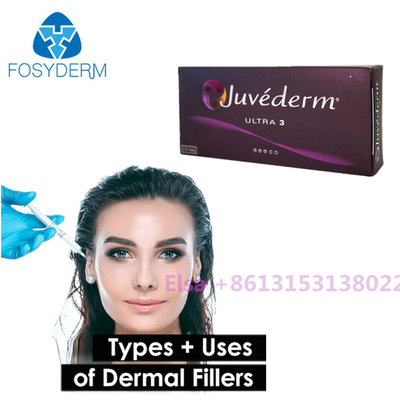 Siringa cutanea di Juvederm dei riempitori di Juvederm ultra/di Voluma con il lido