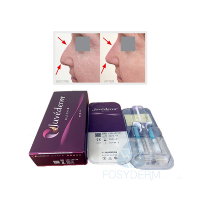 Il labbro del fronte ha unito con legami atomici incrociati il gel acido ialuronico cutaneo di Juvederm Ultra3 del riempitore