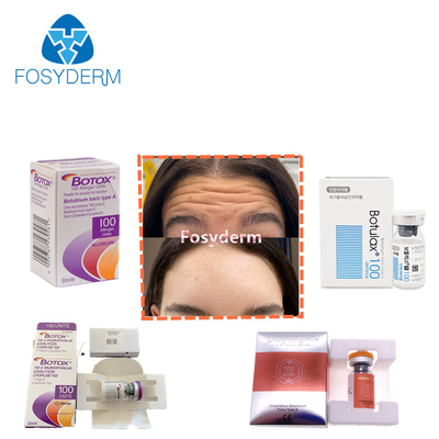 grinze  Allergan dell'iniezione della tossina botulinica di 100units TypeA anti
