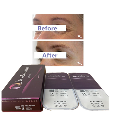 Riempitore cutaneo acido ialuronico 24mg del labbro del riempitore di Juvederm 2ml Ultra3 Ultra4 Voluma