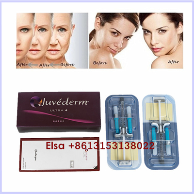 Iniezione cutanea acida ialuronica estetica del gel del riempitore di Juvederm Ultra3 Ultra4 Voluma dei prodotti