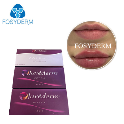 Juvederm Dermal Filler Injection Cross Linked Hyaluronic Acid HA Gel Face Filler Siringa preriempita