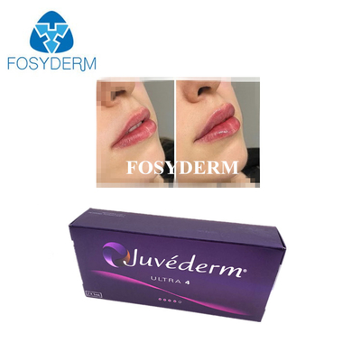 Acido ialuronico coreano incrociato con filler cutaneo Juvederm Lip Filler Injections