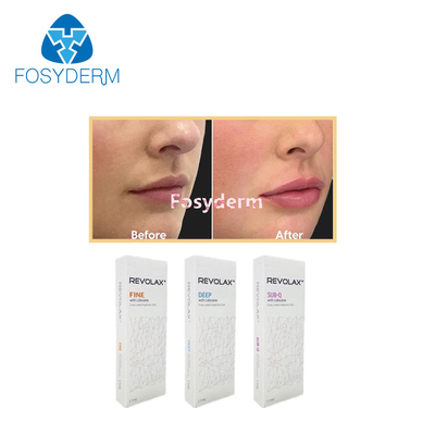 1.1 ml Riempitivi per labbra cutanei Revolax Fine Deep Sub-Q per anti rughe Iniezione di acido ialuronico