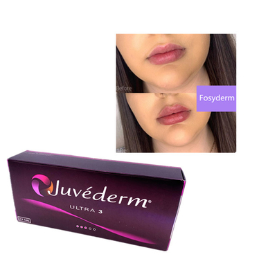 2 ml Juvederm Acido Ialuronico Riempitore Dermico Riempitore di Rughe mento Labbra Ultra 3