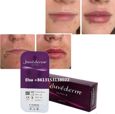 Cosmetici Iniezioni per la cura della pelle Lip Plumper Juvederm Filler Iniezione per il naso mento labbra