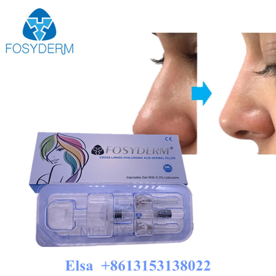 Fosyderm Deep 2ml Dermal Filler per il ringiovanimento facciale HA Filler