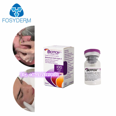Allergan  Toxina Botulinica 100 UI  Iniezione Dysport 500 anti- rughe