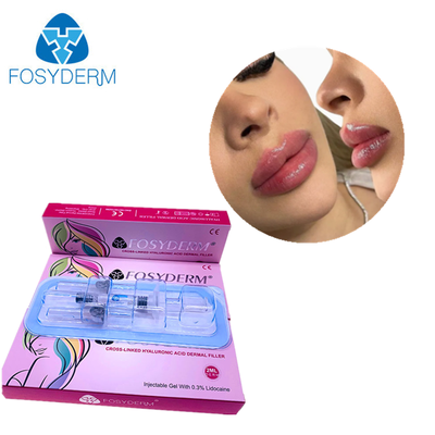 Fosyderm Filler Acido Ialuronico Filler Dermico Iniezione per labbra 2ml