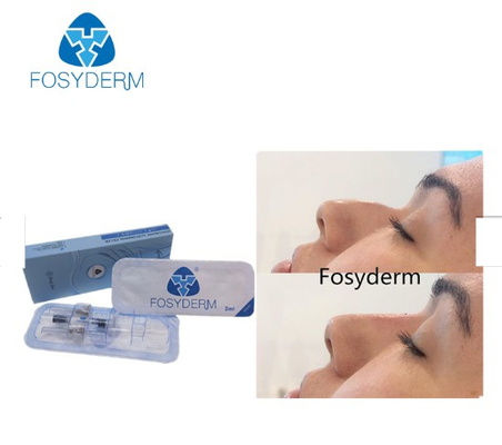 L'incrocio di Fosyderm ha collegato la linea profonda riempitore cutaneo del riempitore 2ml per Nose Up