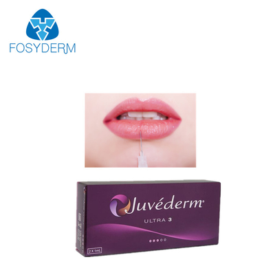 Riempitore cutaneo acido ialuronico ultra 3 2*1ml di Juvederm del labbro