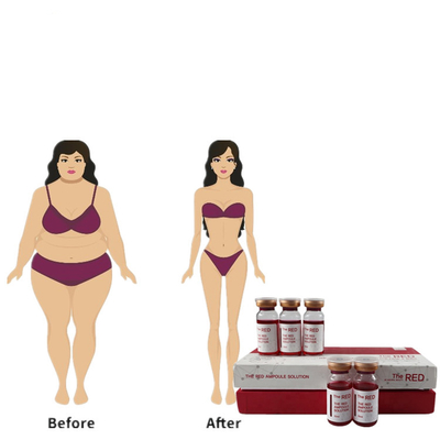 Iniezione lipolitica di Mesotherapy di lassismo rosso meso di Lipo Lipo