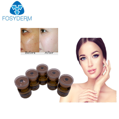 siero di 20mg/ml 5ml Mesotherapy che imbianca soluzione mesa