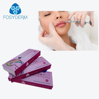 Il riempitore cutaneo collegato trasversale 2Ml Derm dell'ha per raggiungere il potenziamento delle labbra vicino inietta