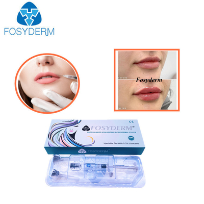 una linea potenziamento cutaneo iniettabile acido ialuronico da 1,1 ml Derm del labbro del riempitore