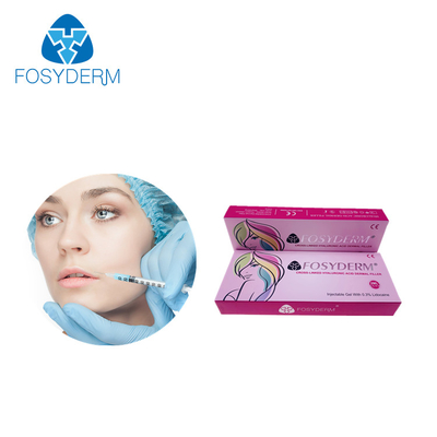 Riempitore cutaneo acido ialuronico delle iniezioni dei riempitori cutanei del labbro di Fosyderm 2ml