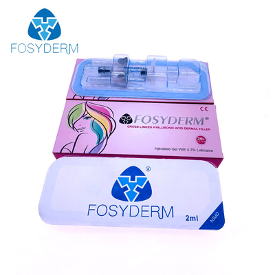 Le labbra più grassoccie di un incrocio da 2 ml Fosyderm hanno collegato il riempitore acido ialuronico