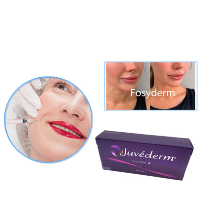 Juvederm ultra 3 ultra 4 iniezione cutanea del gel del riempitore di Voluma ha