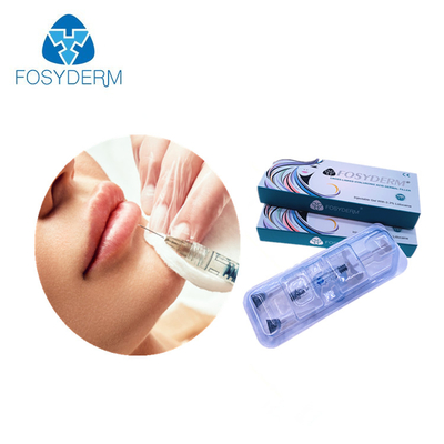 Riempitore acido ialuronico del sodio del gel per il labbro 1.1ml iniettabile