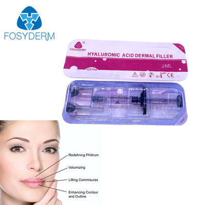 pienezza delle labbra 2ml iniettando il riempitore cutaneo acido ialuronico di Fosyderm