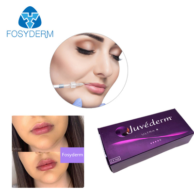 Riempitore cutaneo acido ialuronico 24mg/Ml del labbro di Juvederm del gel del riempitore di Ultra3 Ultra4 Voluma