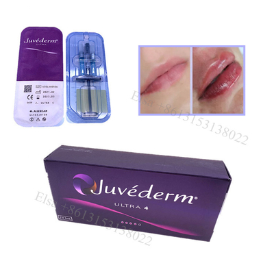 Juvederm Ultra4 Filler dermico Filler per labbra Lifting facciale Ha Gel Iniezione