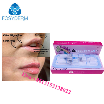 Acido ialuronico Ha Iniezioni 1 ml 2 ml 5 ml