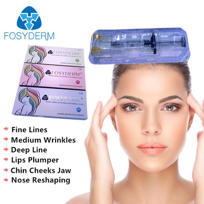 le labbra di 2ml Fosyderm fiutano il riempitore di Chin Filling ha che riduce le grinze